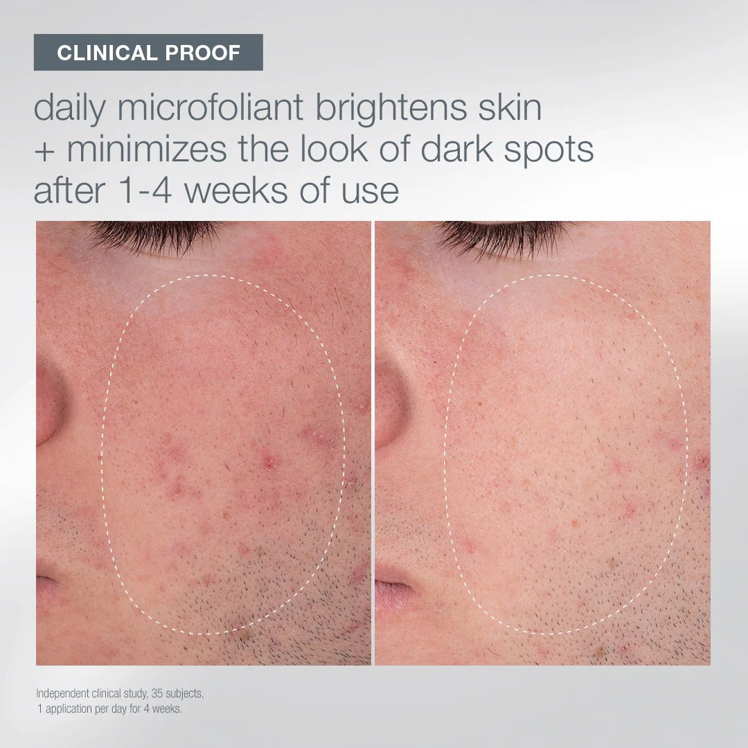 First Snow of the Season Kit