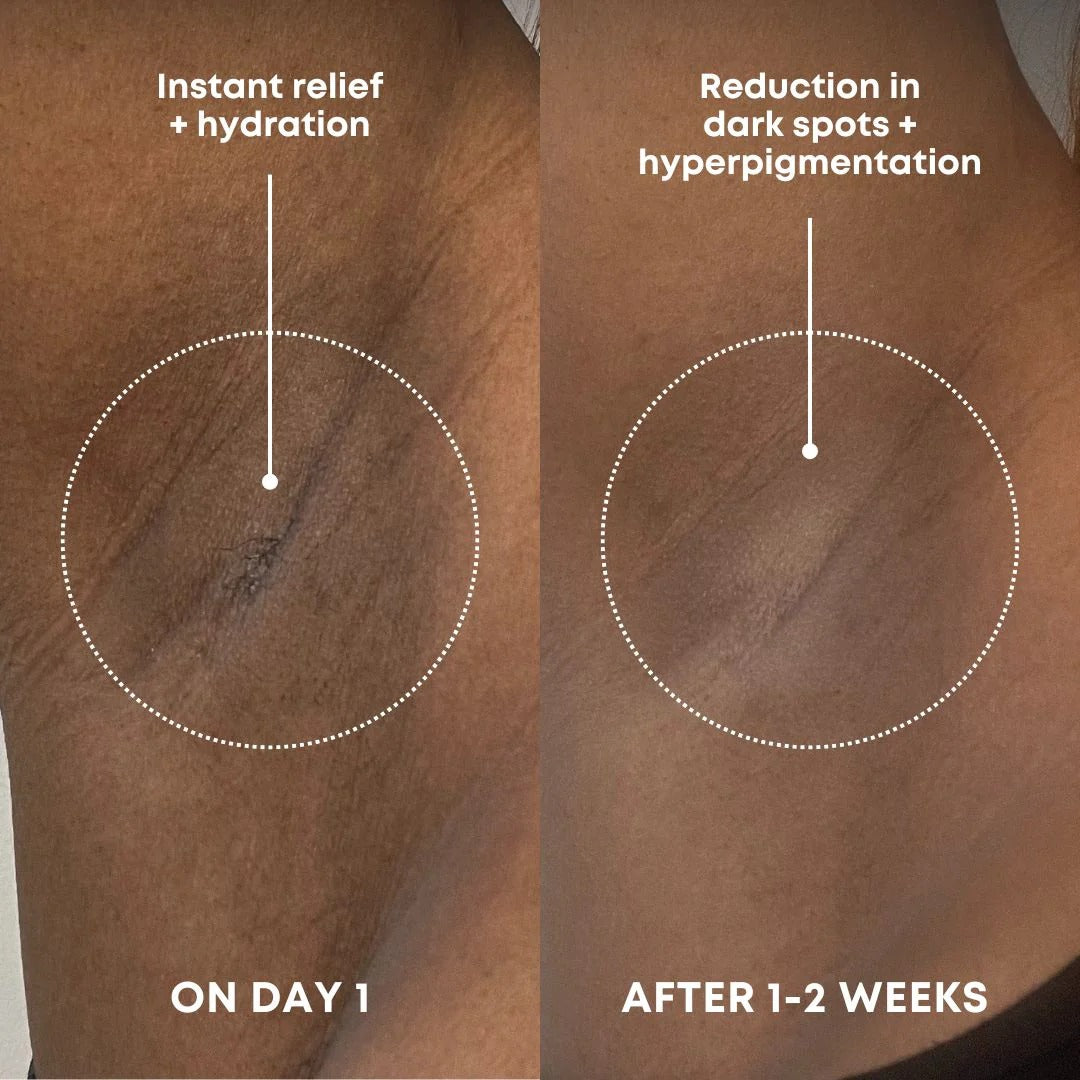 Bermuda Dark Spot Exfoliating Scrub