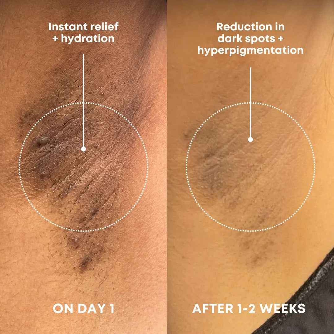 Bermuda Dark Spot Exfoliating Scrub