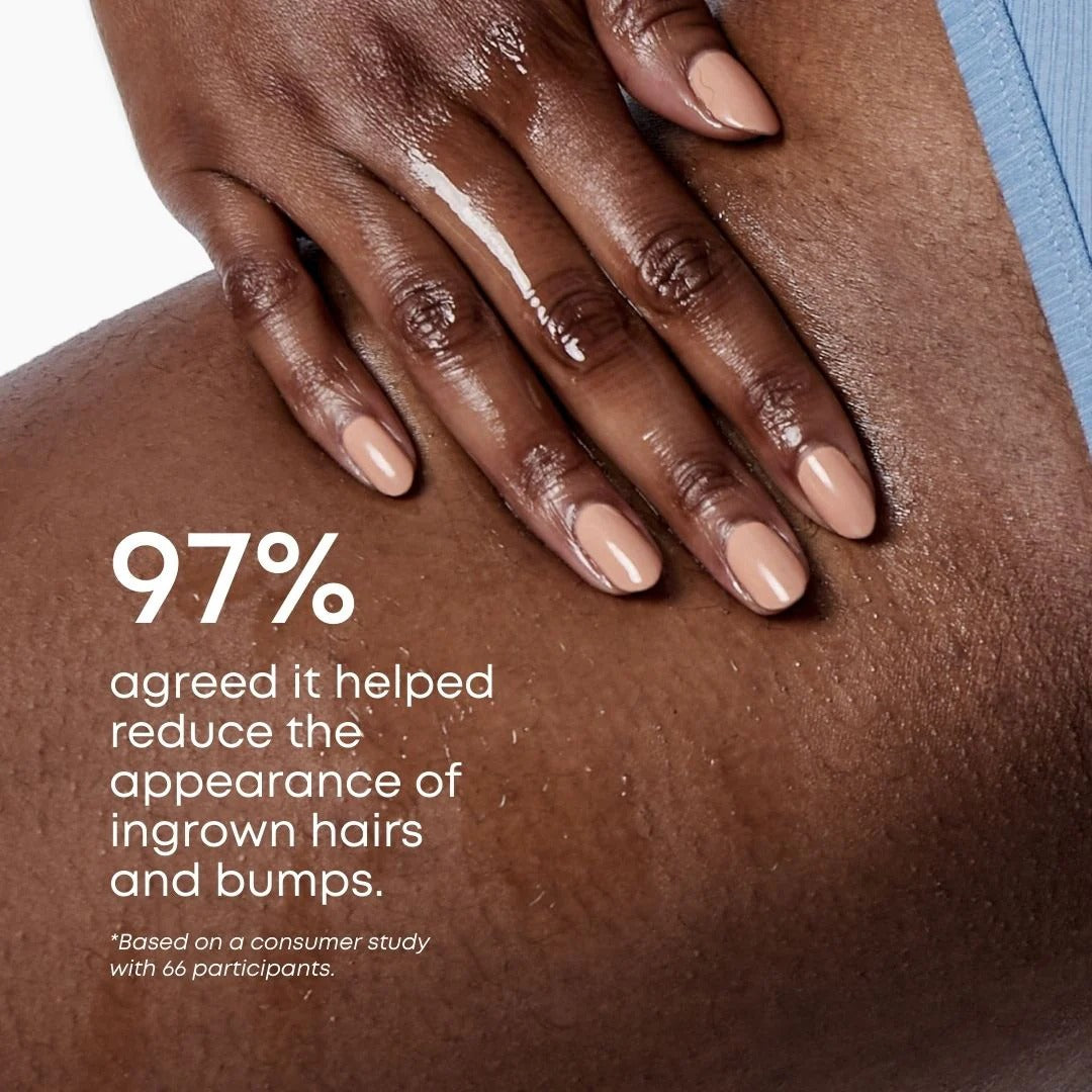 Sweet Escape Ingrown Hair Oil